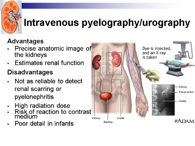Intravenous pyelography/urography Advantages Precise anatomic image of the kidneys  Estimates renal function 